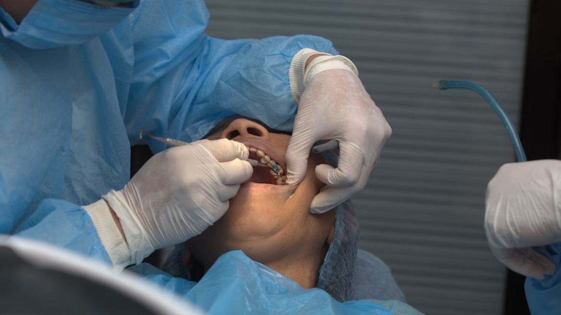 Professional dental care