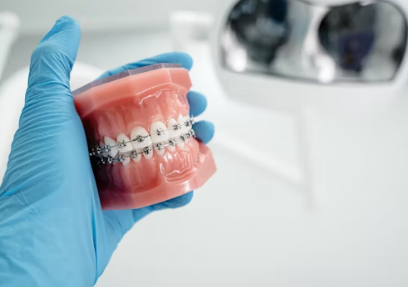 Understanding Dental Implants